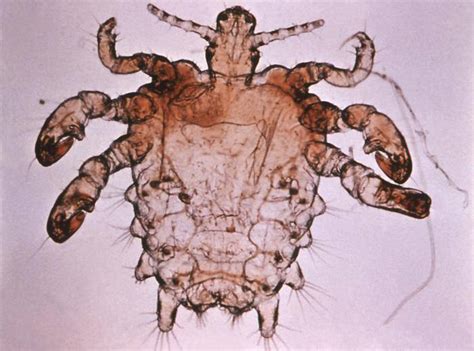 Pubic Lice Crabs Facts On Transmission Life Span Infestation