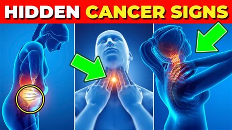 10 Unnoticed Cancer Symptoms You Should Never Ignore Youtube