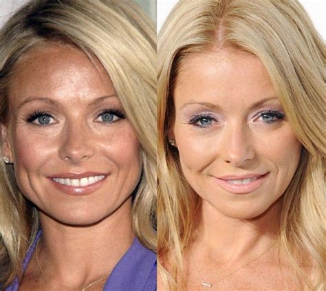 Pin By Caty Stud On Kelly Ripa Plastic Surgery Plastic Surgery Kelly