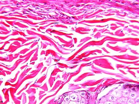 Dense Connective Tissue Microanatomy Web Atlas Gwen V Childs Phd