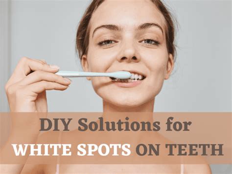 Causes Of White Spots On Teeth And How To Fix Them At Home Youmemindbody