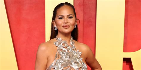 Chrissy Teigen Addresses Scarring From Plastic Surgery On Her Breasts