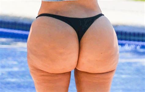 Pics Kim Kardashian Rumored Plastic Surgery Doc Roasts Her Butt