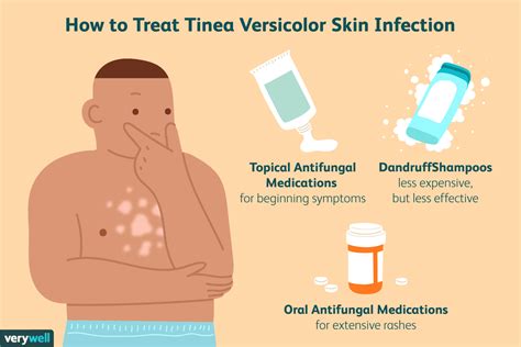 Beste Behandlungen Für Tinea Versicolor Hautinfektion Medde