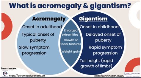 acromegaly and gigantism r acromegaly