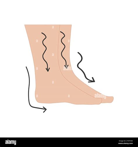 swelling leg cut out stock images and pictures alamy