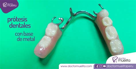 Prótesis Dentales Con Base De Metal Clínica Doctor Muelita