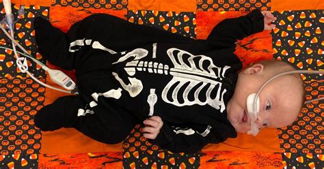 Nicu Babies Dress Up For Halloween At Childrens Health