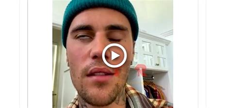 Justin Bieber Face Paralysis Video