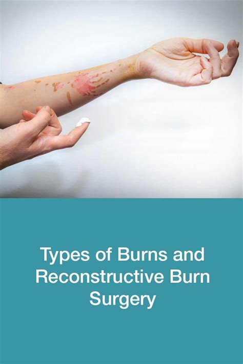 Burns Types And Reconstructive Burn Surgery Dubai Cosmetic Surgery