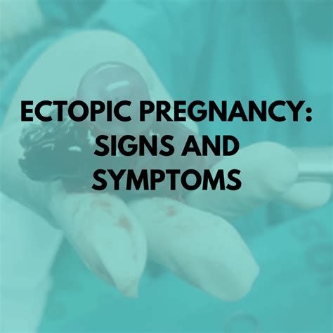 Ectopic Pregnancy Signs And Symptoms