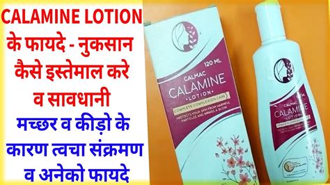 Calamine Lotion Benefits And How To Use And Side Effects।खुजलीलालीपन