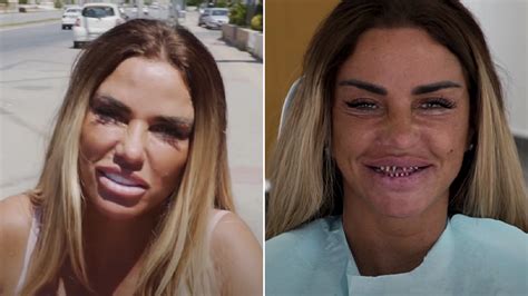 Jun 15, 2021 · katie price risks hotel quarantine as she jets turkey for £12,000 surgery with carl woods; Katie Price all smiles as she shows off new teeth after ...