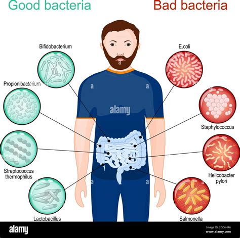 Buenas Y Malas Bacterias Póster Sobre Probióticos Y Salud Intestinal