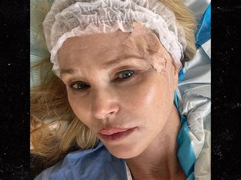 Christie Brinkley Reveals Skin Cancer Diagnosis Shares Surgery Photos