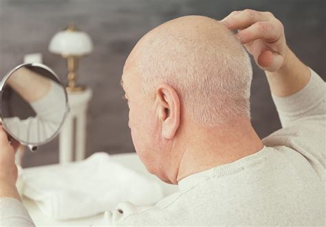 Famous Baldies Throughout History Denver Hair Restoration