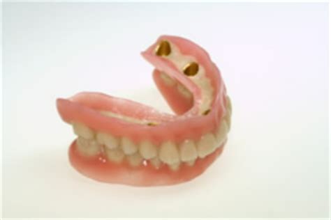 It's definitely worth your while to do everything you can to find affordable dental coverage for your dentures. Deckprothese beim Zahnarzt