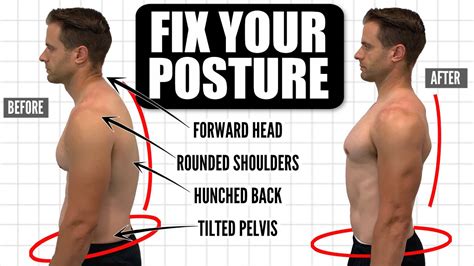 How To Fix Bad Posture Lower Back How To Fix Poor Posture Caused By Over Arching The Low Back