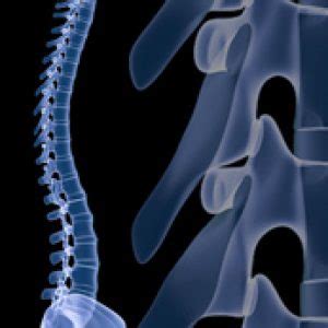 Scoliosis New Jersey Spine Specialists