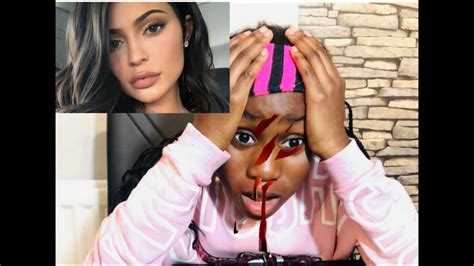 Kylie Jenner Lip Challenge Injuries K7off