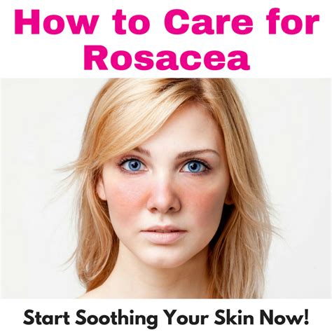 Free Cheat Sheet How To Calm Rosacea