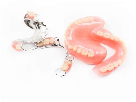 Missing Back Teeth Olds Denture And Implant Centre