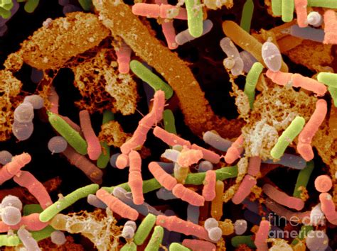 Toddlers Feces With Bifidobacteria Sem Photograph By Scimat Pixels