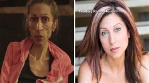 Rachael Farrokh Recovering From Battle With Anorexia Abc7 New York