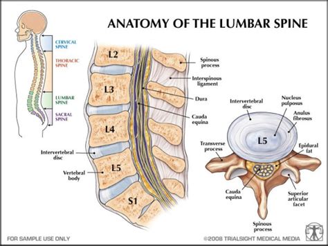 Post Op Lower Lumbar Spinal Fusion L4l5s1 Wlaminectomy Pain