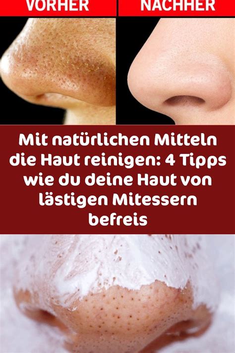 Gebe heißes wasser in eine große schüssel. Mit natürlichen Mitteln die Haut reinigen: 4 Tipps, wie du ...