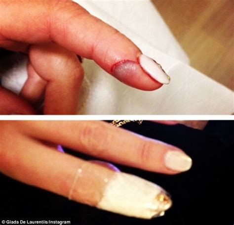 Ouch Celebrity Chef Giada De Laurentiis Slices Her Finger During Live