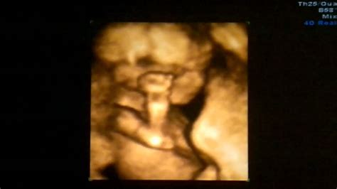 3d And 4d Ultrasound 16 Weeks Youtube