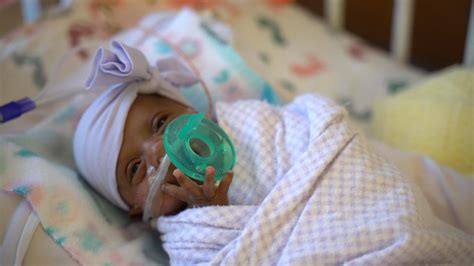 saybie world s tiniest surviving micro preemie newborn girl revealed by sharp mary birch