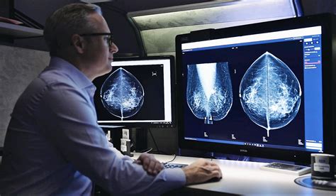 Will Ai Identify Breast Cancer Better Than Radiologists In Actual