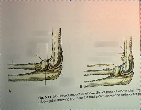 Lateral Aspect Of Elbow With Fat Pads Anatomy Diagram Diagram Quizlet