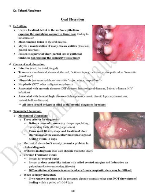 5 Oral Ulceration Diseases And Disorders Medicine