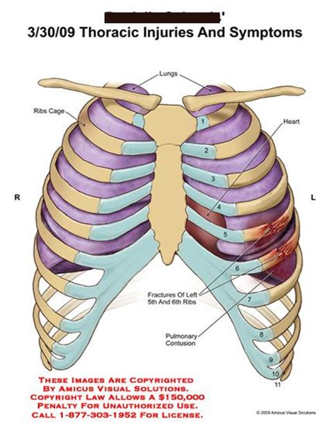 Lungs Behind Ribs Fresh Air In The Lungs Behind The Ribs Adequate