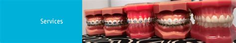 Accelerated Orthodontic Treatment Grand Prairie Irving TX