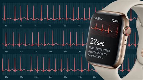 How Accurate The Ecg Is On Your Apple Watch Qaly