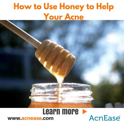 The Benefits Of Using Honey To Help Your Acne From The Inside Out