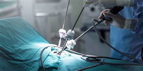 Laparoscopic Surgery For Uterovaginal Prolapsed R L Memorial Hospital