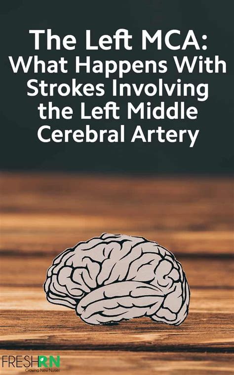 Left MCA Strokes What Happens With Strokes Involving The Left Middle Cerebral Artery FRESHRN