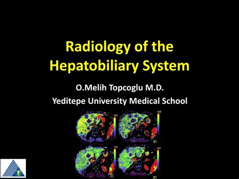 Ppt Radiology Of The Hepatobiliary System Powerpoint Presentation