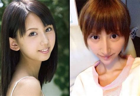 Japanese Porn Star Pre And Post Plastic Surgery 14 Pics Free Download