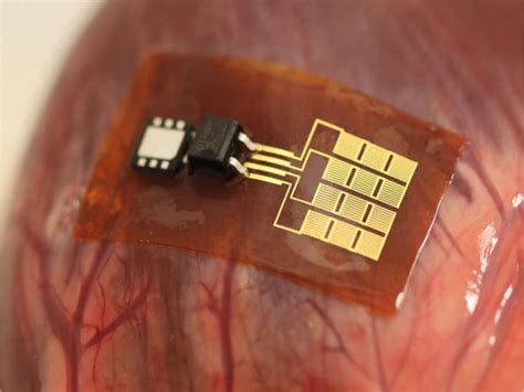 New Nanoribbon Implant Powers Pacemakers With Heartbeats