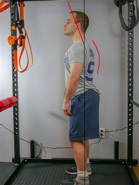 Static Posture Assessment Strong Links Fitness