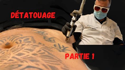 Jefface Mon Tatouage Au Laser Partie 1 Youtube