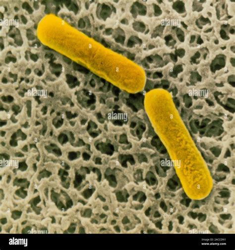 Scanning Electron Micrograph Of Two Individual Rod Like Gram Positive
