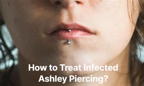 How To Treat Infected Ashley Piercing Full Guide After Sybil