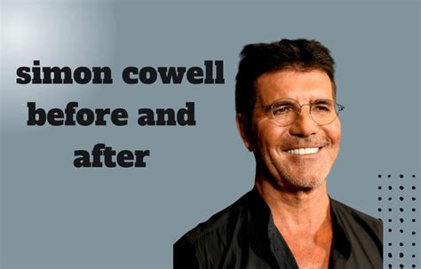 Did Simon Cowell Has Undergone Plastic Surgery Before And After
